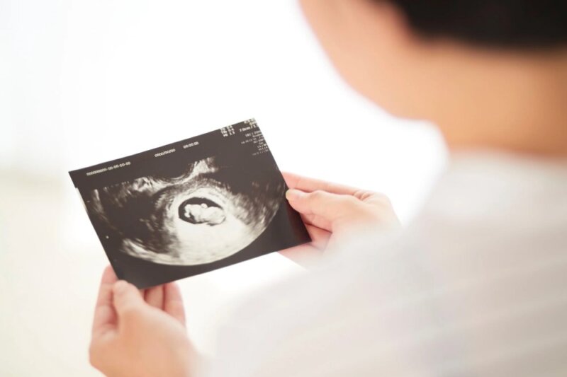 Frau betrachtet das Ultraschallbild ihres Babys
